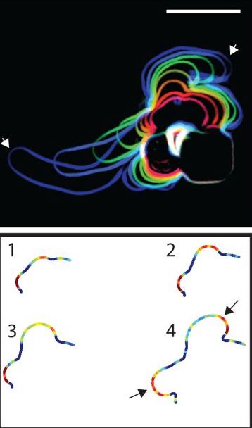 Bacterial segmentation
